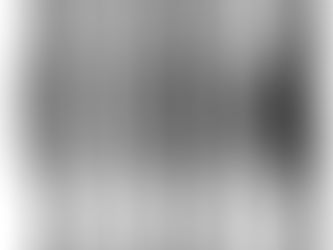 你的身体哪个部位肥胖?知道为什么吗?