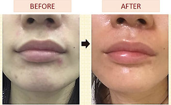 ヒト幹細胞 ビフォアフ4.jpg