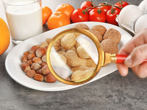 ALERGIAS ALIMENTARIAS