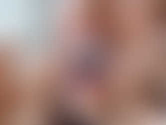 The Benefits of Invisalign®: Why Choose Clear Aligners Over Traditional Braces?