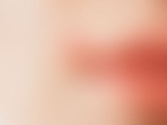 cropped view of herpes on lips of sick woman