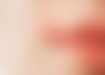 cropped view of herpes on lips of sick woman