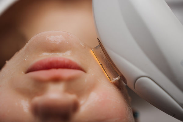 Phototherapy, photorejuvenation, IPL in a beauty salon. Care for a woman's face. High qual