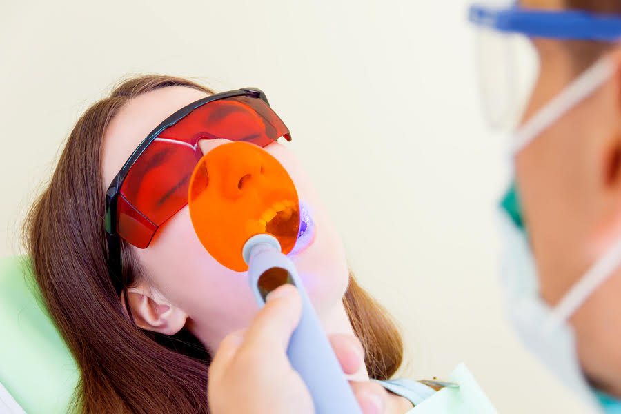 Everything you need to know about dental sealants