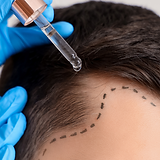 chute de cheveux, soin cheveux, soin esthetique.png