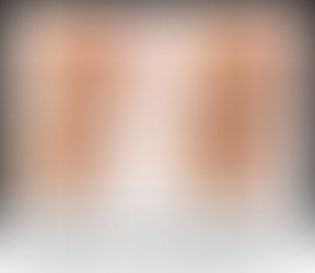 Artrose e atividade física