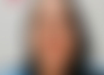 Mãe denuncia que a imagem da filha menor portadora de microcefalia está sendo explorada por golpistas 