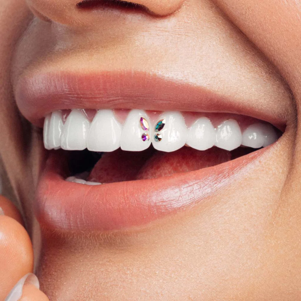 Lächeln mit Zahnschmuck Twinkles ®: funkelnde Zahnverzierungen