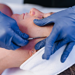 Dermaplaning Behandlung: sanfte Gesichtshaarentfernung Limburg