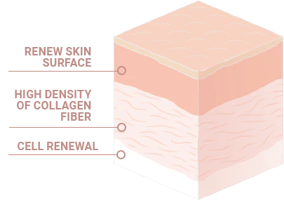 Hautstruktur-Diagramm: Epidermis, Dermis, Subcutis