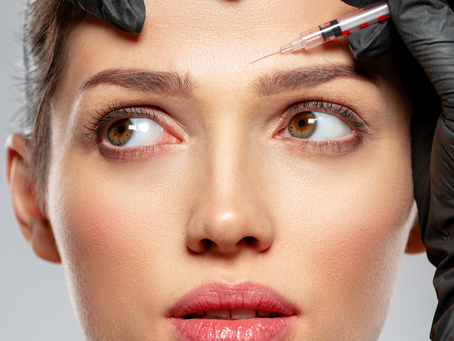 Wat ze niet vertellen over Botox - maar je wel wil weten