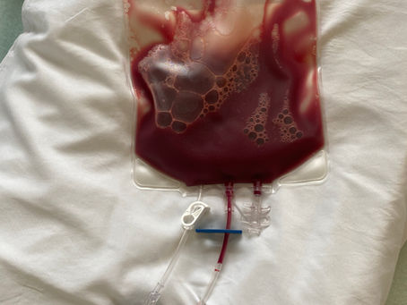 Autologous Stem Cell Transplant - An Outpatient's Tale