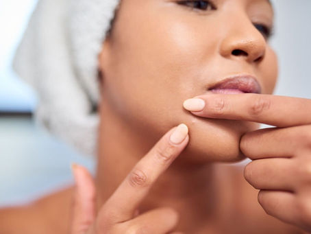 The Healing Power of Chinese Medicine for Pimples