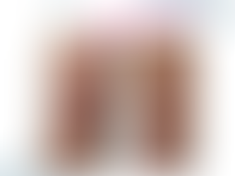 Why Is Linda Evangelista Sueing After 'Fat Freezing@ with Coolsculpting