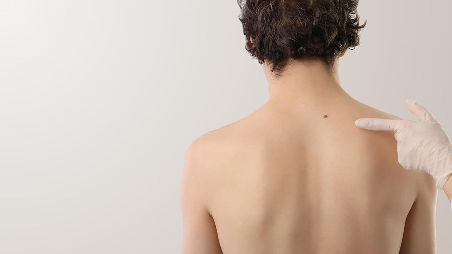 Plasma Pen Treatments  - Hero Image - We Love Beauty.jpg