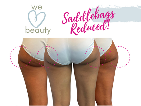 Are You Ready For The Month Of Love?