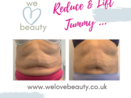 Do You Carry More Belly Fat Than When You Were Younger?