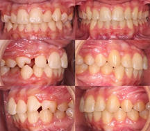 braces-venetoClinic-01.jpeg