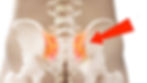 sacro iliaque versailles osteopathe