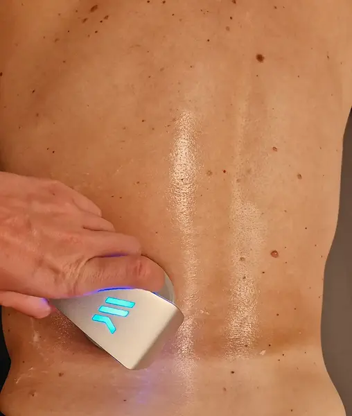 tecartherapie versailles thomas romangas
