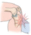 maladie d'osgood osteopathe versailles