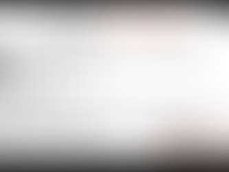 一般的な頭痛の分類と要因について