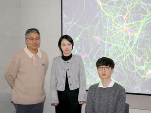 DGIST предлагает новое лечение болезни Хантингтона, трудноизлечимого заболевания головного мозга