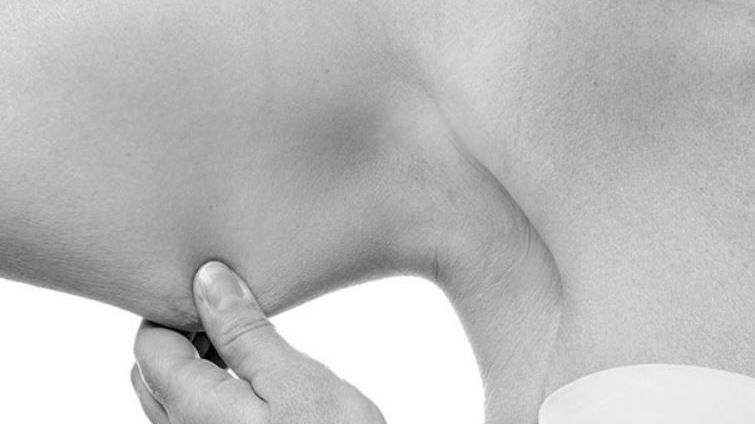 flacidez clinica fabio carramaschi.JPG