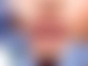 Efeitos do uso de toxina botulínica e de preenchedores na face