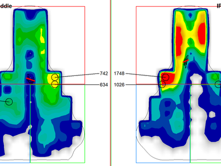 פציעות מפשעה ורצפת אגן בגברים רוכבי אופניים