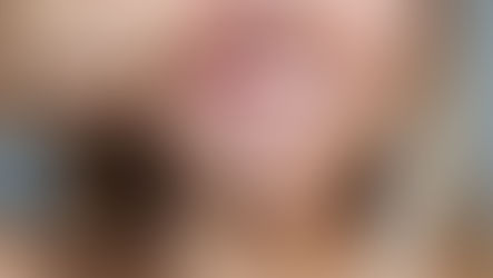 Cara Mengobati Gusi Bengkak