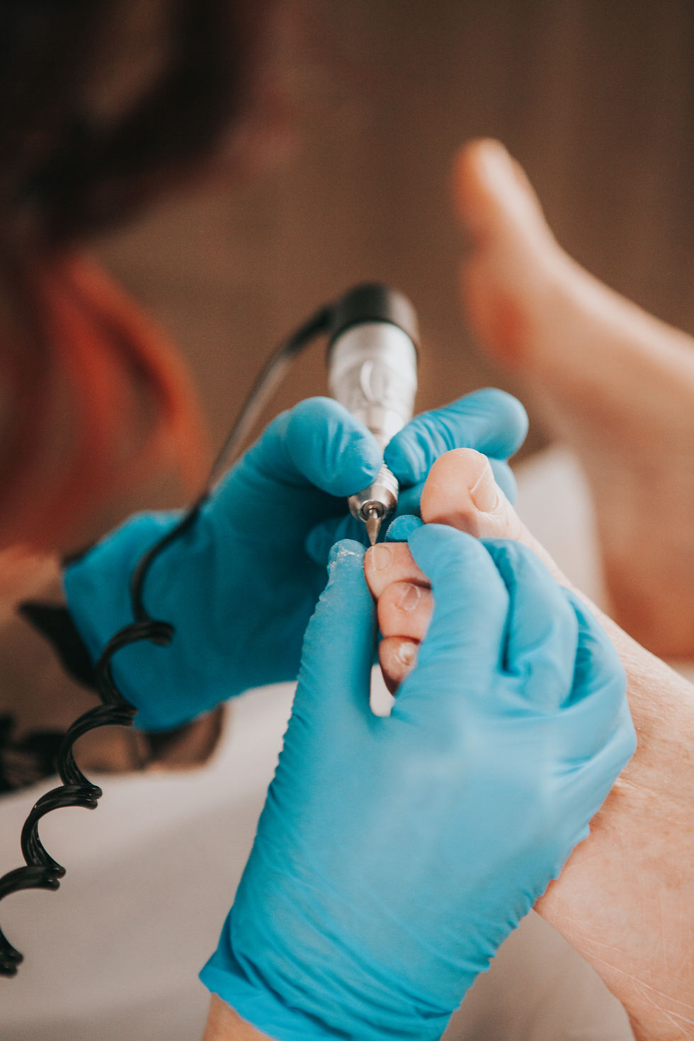 Soin podologique professionnel pour traiter un ongle incarné dans une clinique de soins de pieds à Gatineau