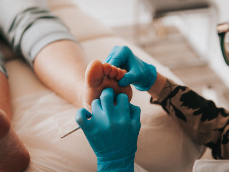 Soin podologique infirmier visant à réduire les callosités et améliorer le confort des pieds à Gatineau.