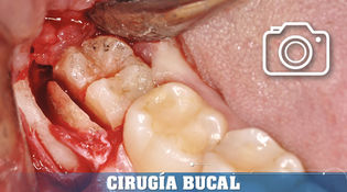 14 Imágenes Disponibles
