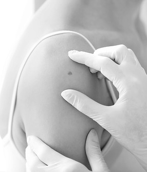 Skin Biopsy_edited.jpg