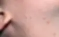 ree