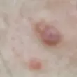 ree
