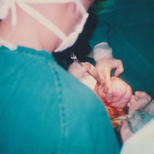 Yo soy mamá por cesárea