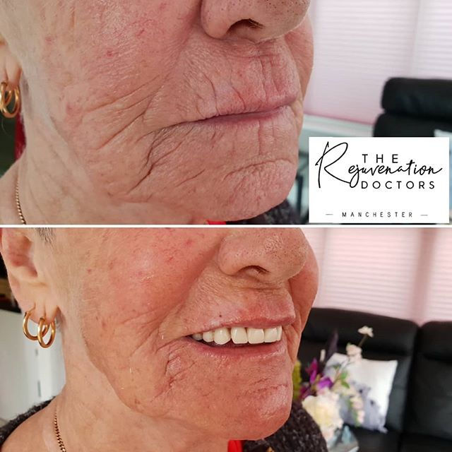 Have a look at this transformation..