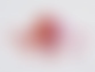 Израильские ученые заставили защитников опухоли ее атаковать