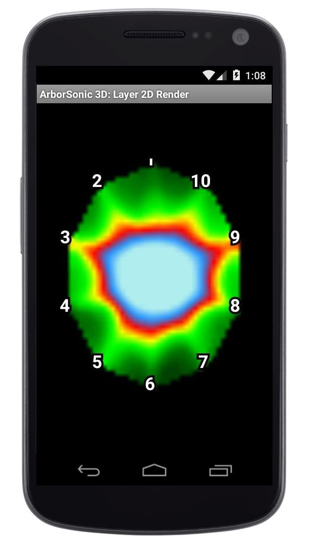 Thumbnail: Arborsonic tomography scan