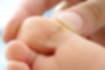 Plantar Warts