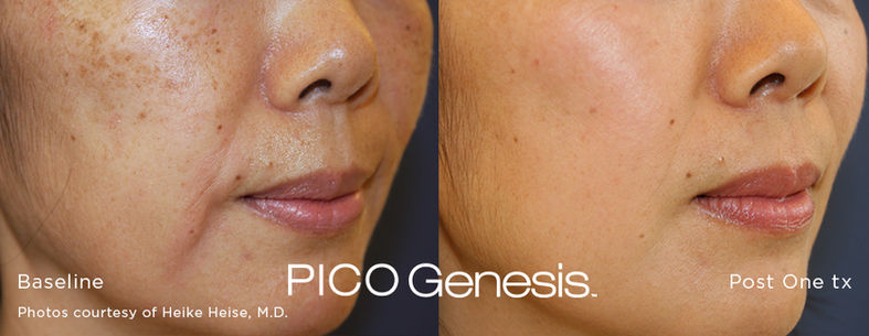 enlighten_pico-genesis_2.jpg