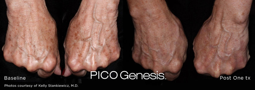 enlighten_pico-genesis_11.jpg