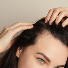 SMP passar även kvinnor. Har du tunt hår kan SMP hjälpa dig. 