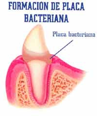 formacion-de-placa-bacteria.jpg
