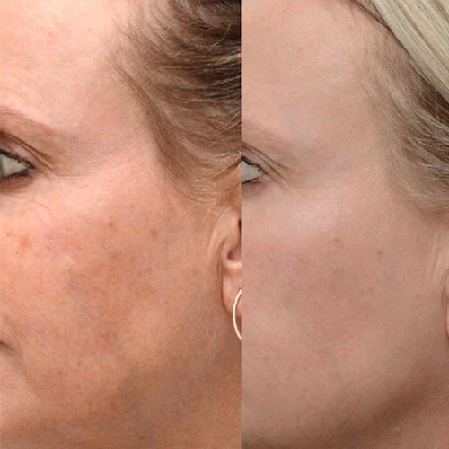 ageing500x500_1200x.jpg.webp