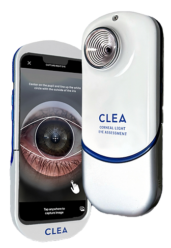 Corneal Light Eye Assessment Device