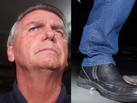 “Eu tenho vergonha de usar tornozeleira”, diz Jair Bolsonaro
