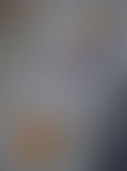 Réflexologie plantaire et diminution du stress